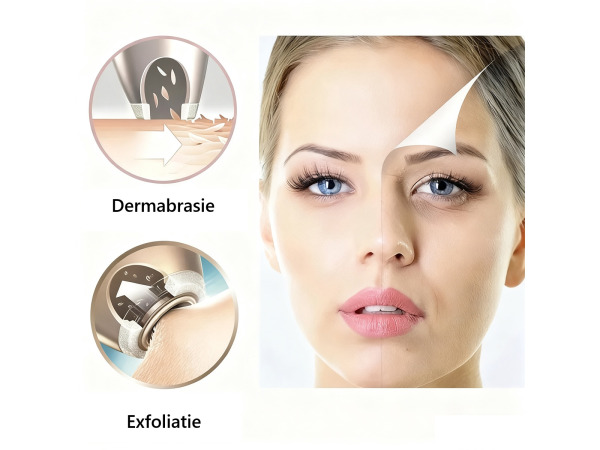Microdermabrasie Apparaat – foto 6 – kavel bij XL Auctions