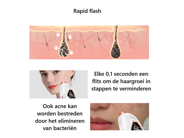 3-in-1 IPL Ontharingsapparaat – foto 2 – kavel bij XL Auctions